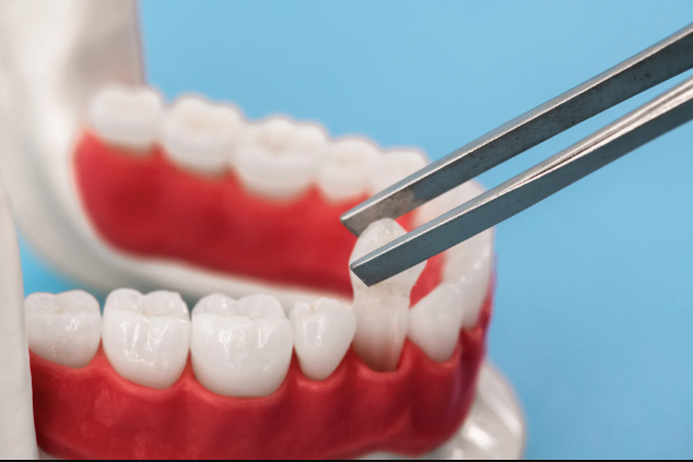 The Science Behind Composite Bonding for Flawless Smiles